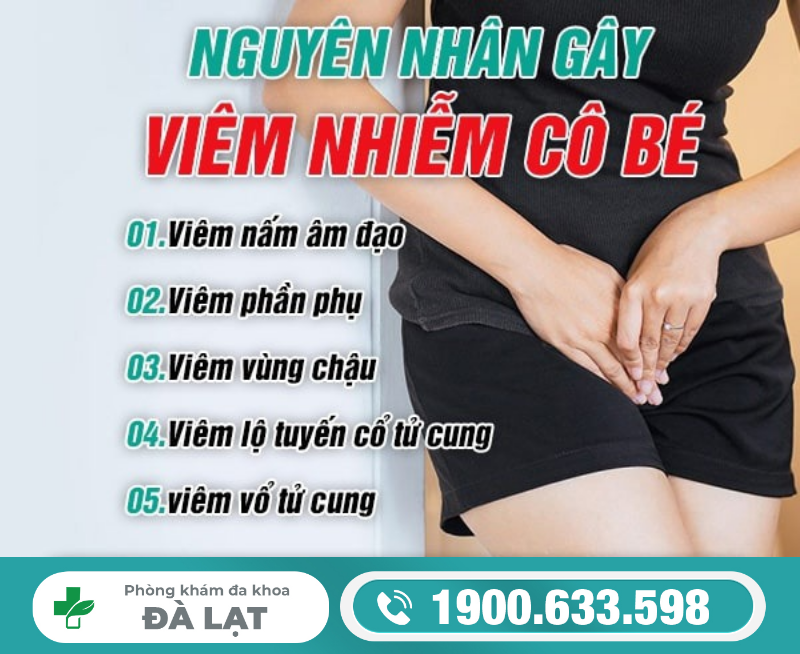 Hình ảnh minh họa